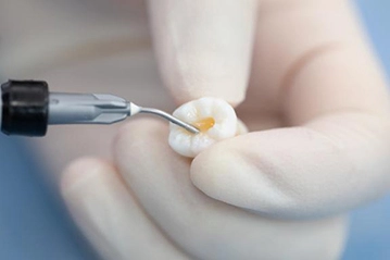 implant materials in dentistry