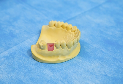 dental implant grafting material