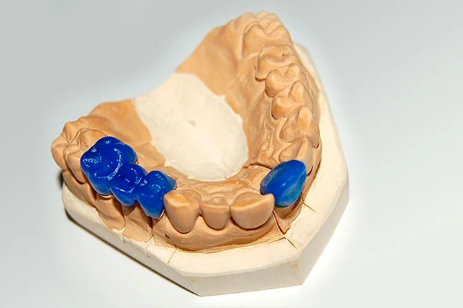 dental inlay casting wax