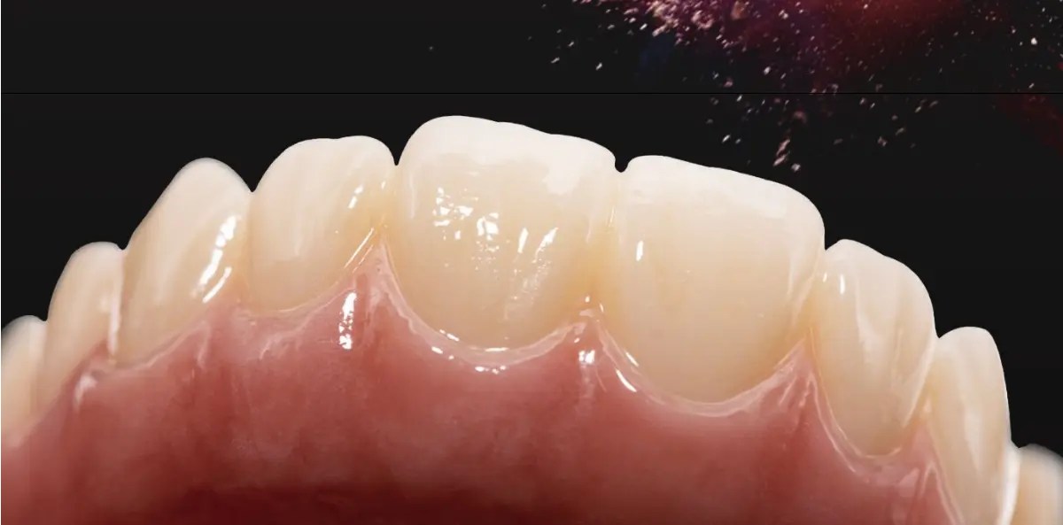 ¡La solución todo en uno para las restauraciones dentales-ENORME MM-4D Zirconia Llegada!