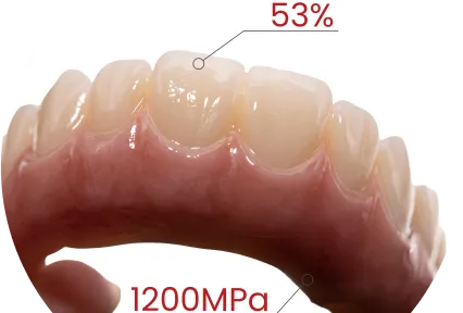 Arco completo listo. Estética incluida. Vea Zirconia MM-4D en casos clínicos reales.